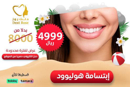 Hollywood smile